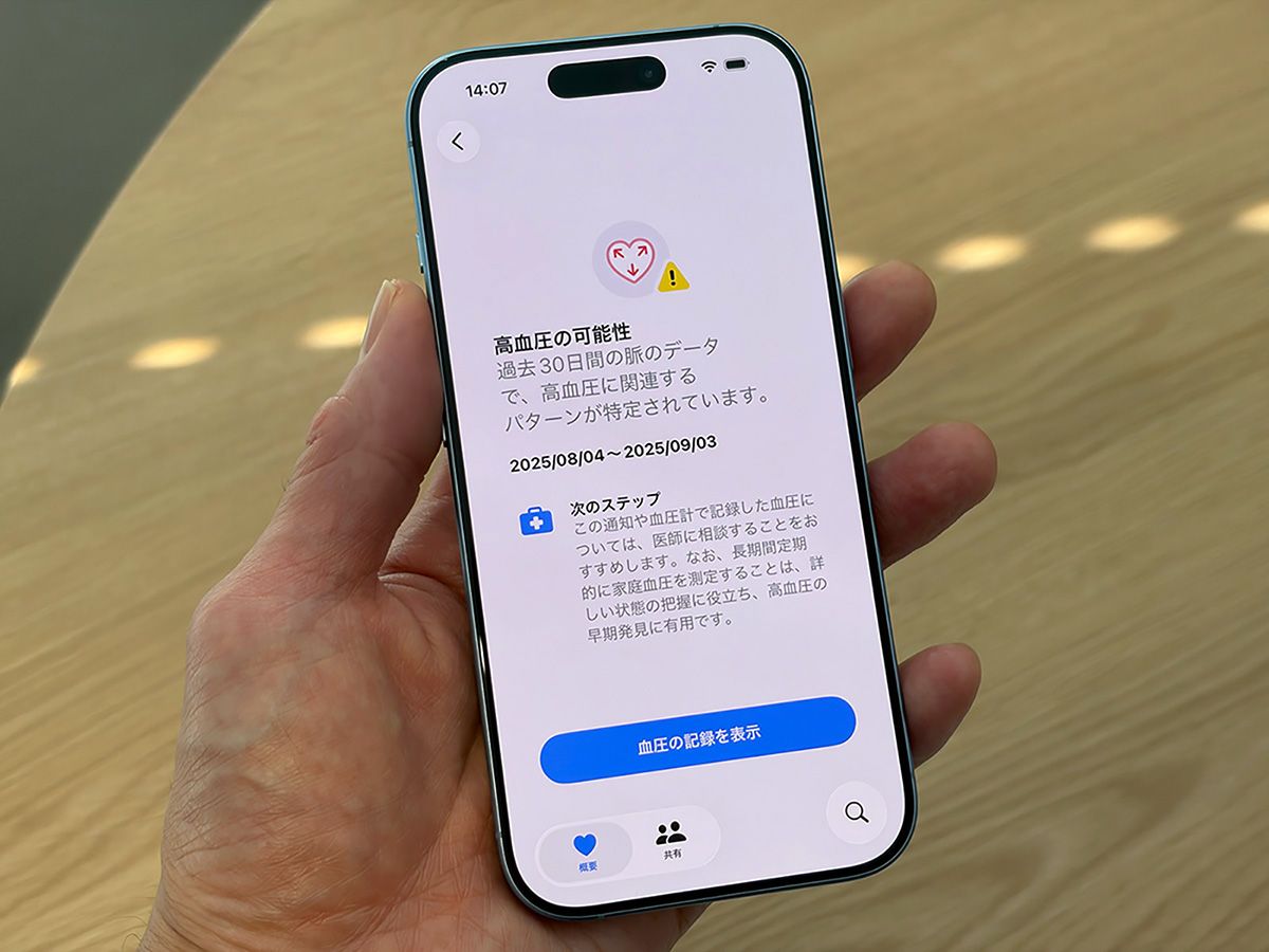 日本でも2025年12月からApple Watchによる高血圧パターンの通知機能が利用できる