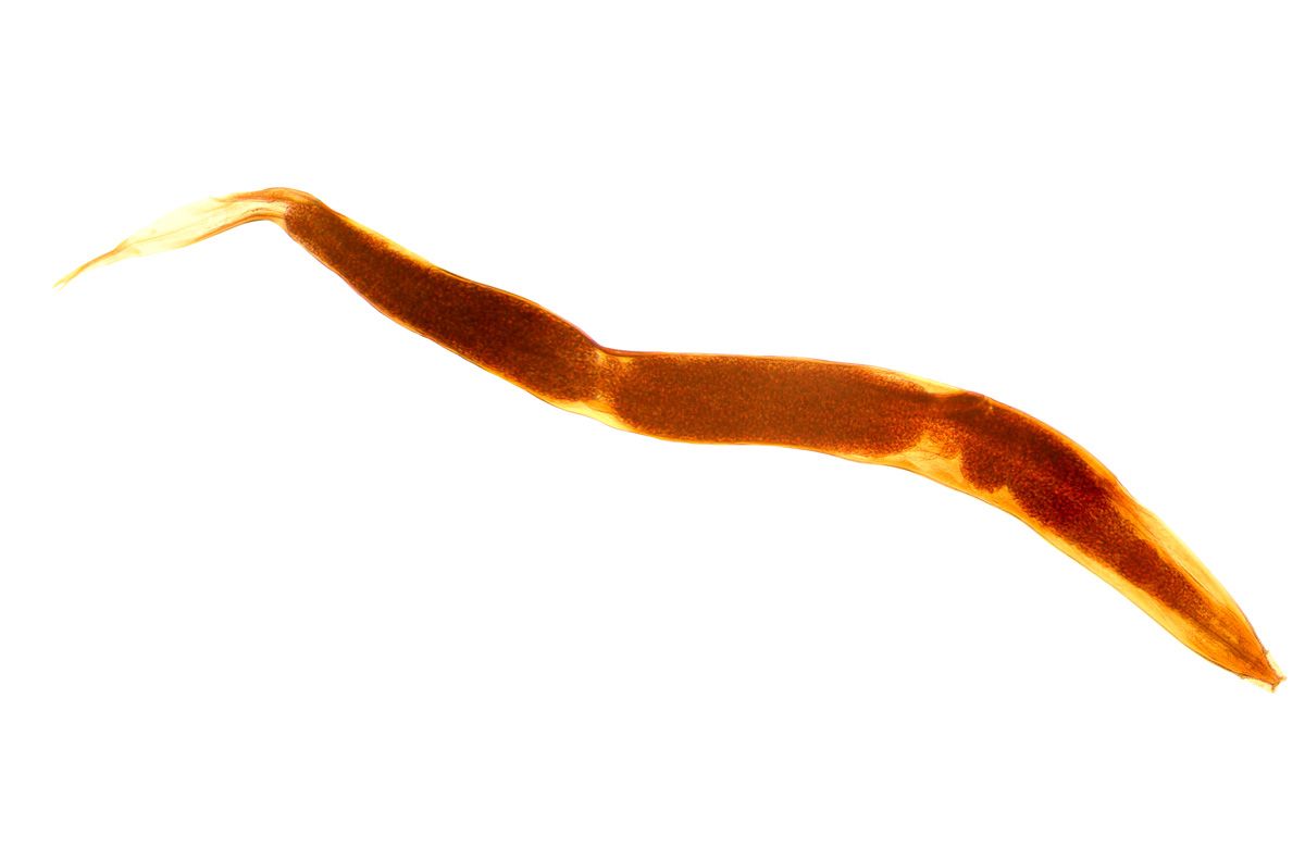 ぎょう虫（stock.adobe.com）