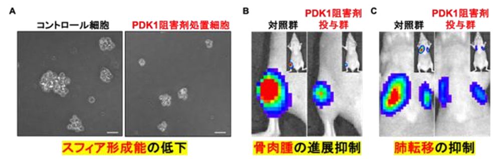 PDK1阻害薬の投与で、スフィア形成、骨肉腫の発展、肺転移がすべて大きく抑制された。