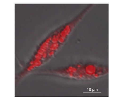脂肪細胞へと成長し脂肪滴を貯めた細胞。