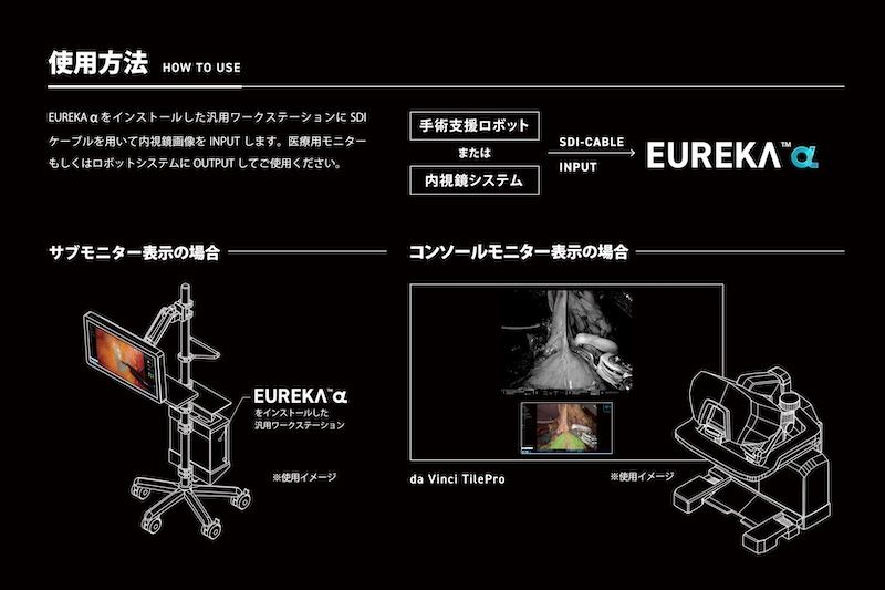 SDIケーブルを手術支援ロボットまたは内視鏡システムに接続するだけで「EUREKA α」をインストールしたワークステーションが働いてくれる。画期的なシステムだ。